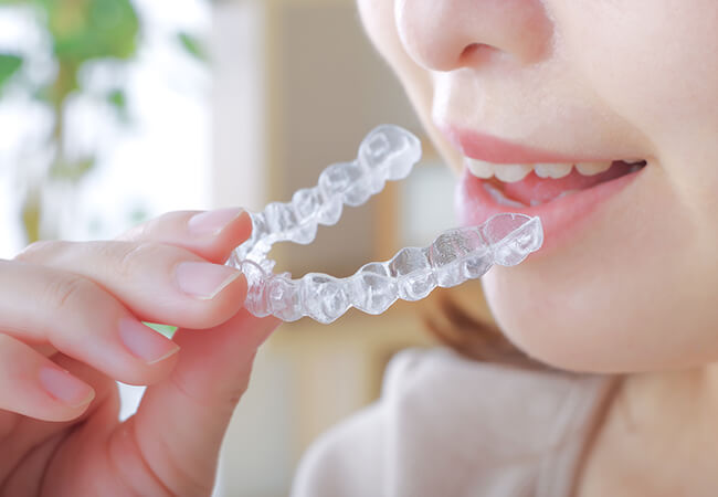 マウスピース矯正